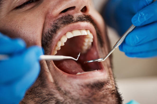Best Dental Fillings (Composite and Amalgam)  in Griggsvle, IL